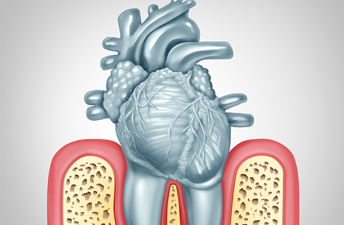 gum-diseases Melbourne