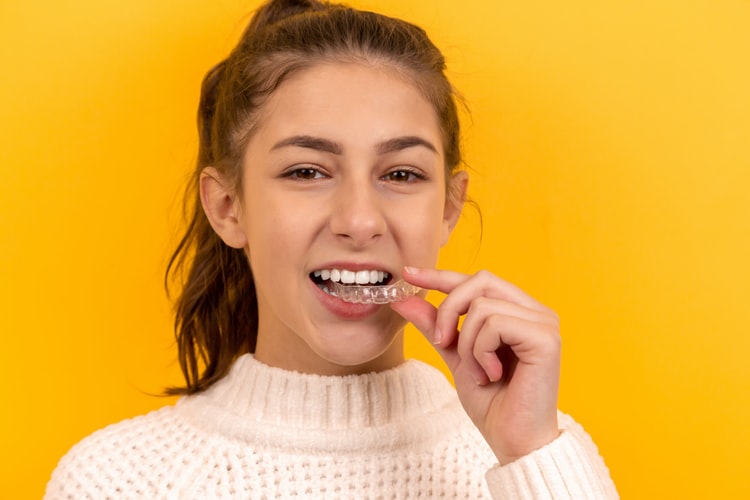 Invisalign Melbourne