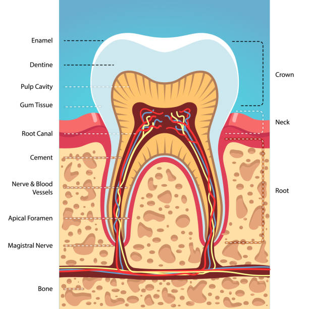 root canal